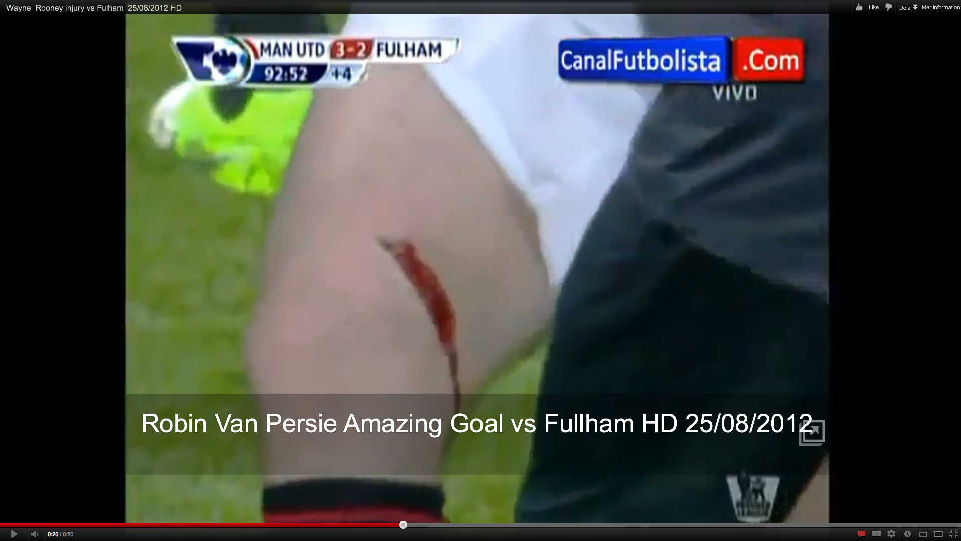 Wayne Rooney, Manchester United, Fulham, Skada
